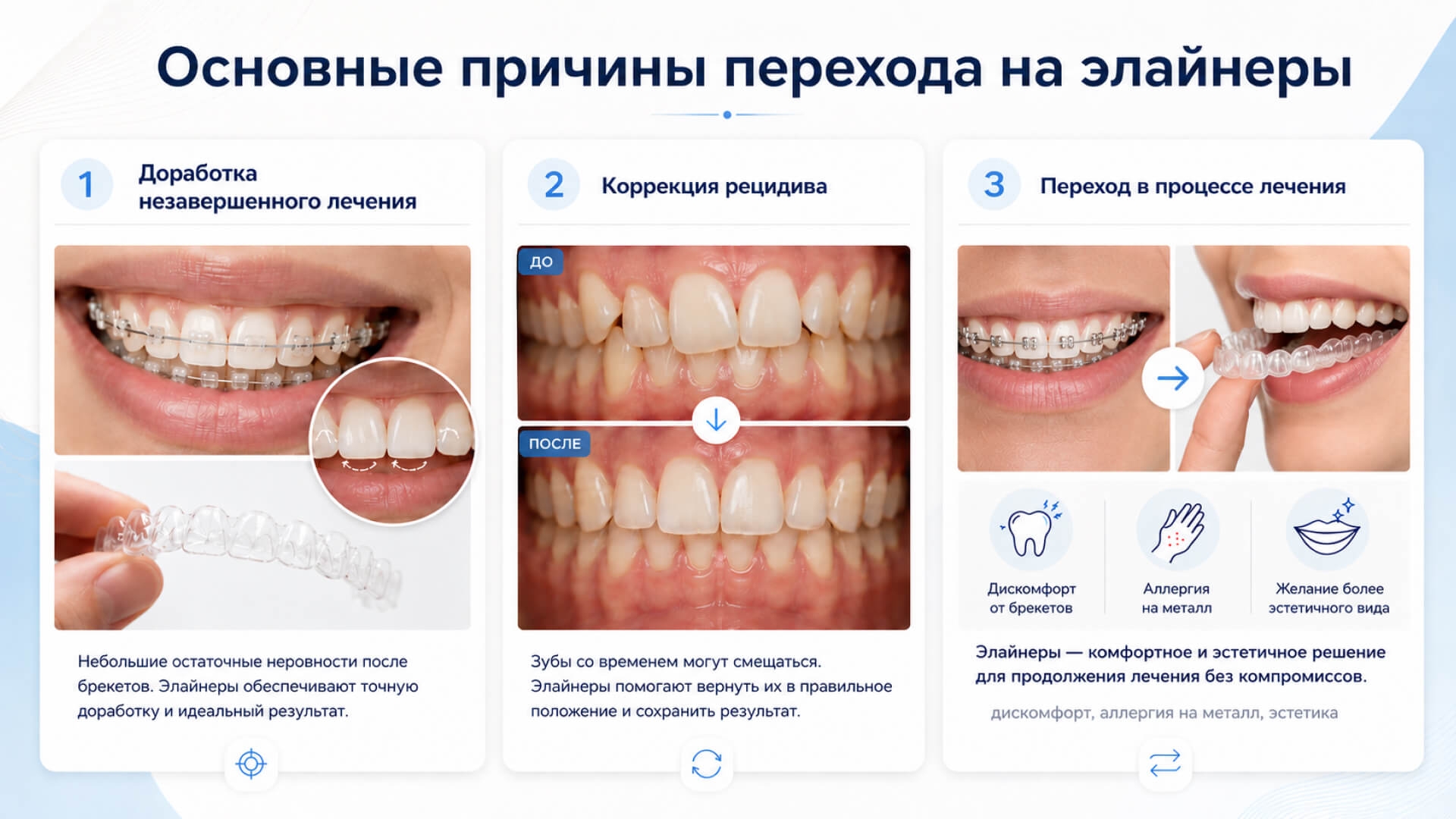 Основные причины перехода с брекетов на элайнеры