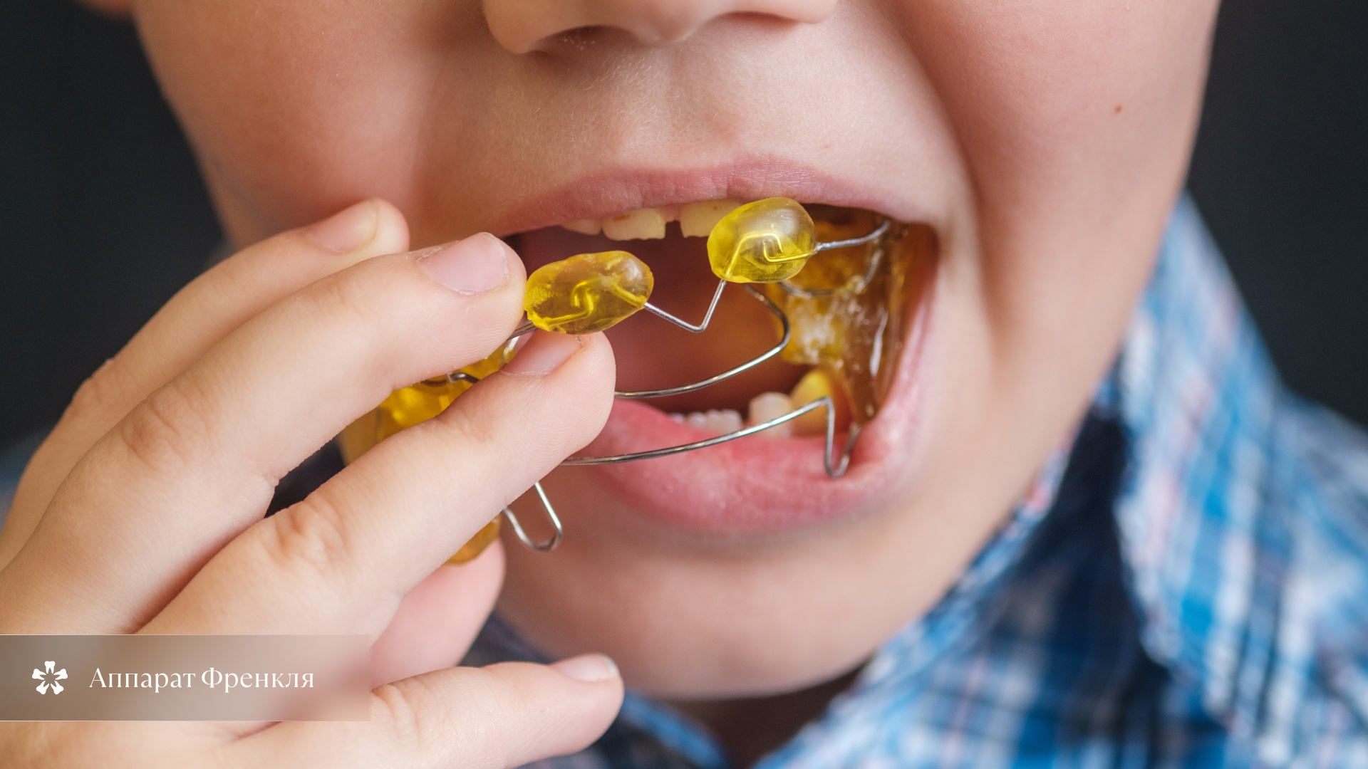 Аппарат Френкля