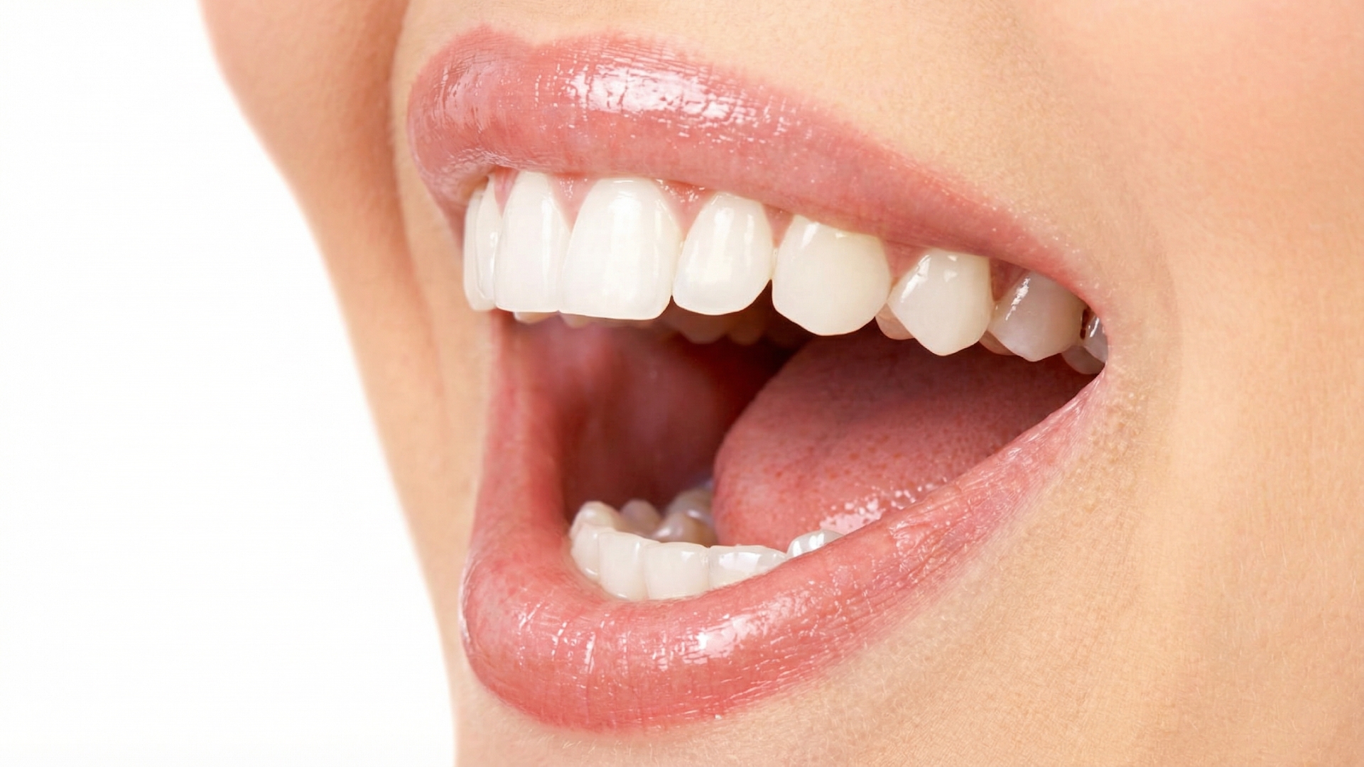blog-how-prepare-teeth-whitening-002.jpg