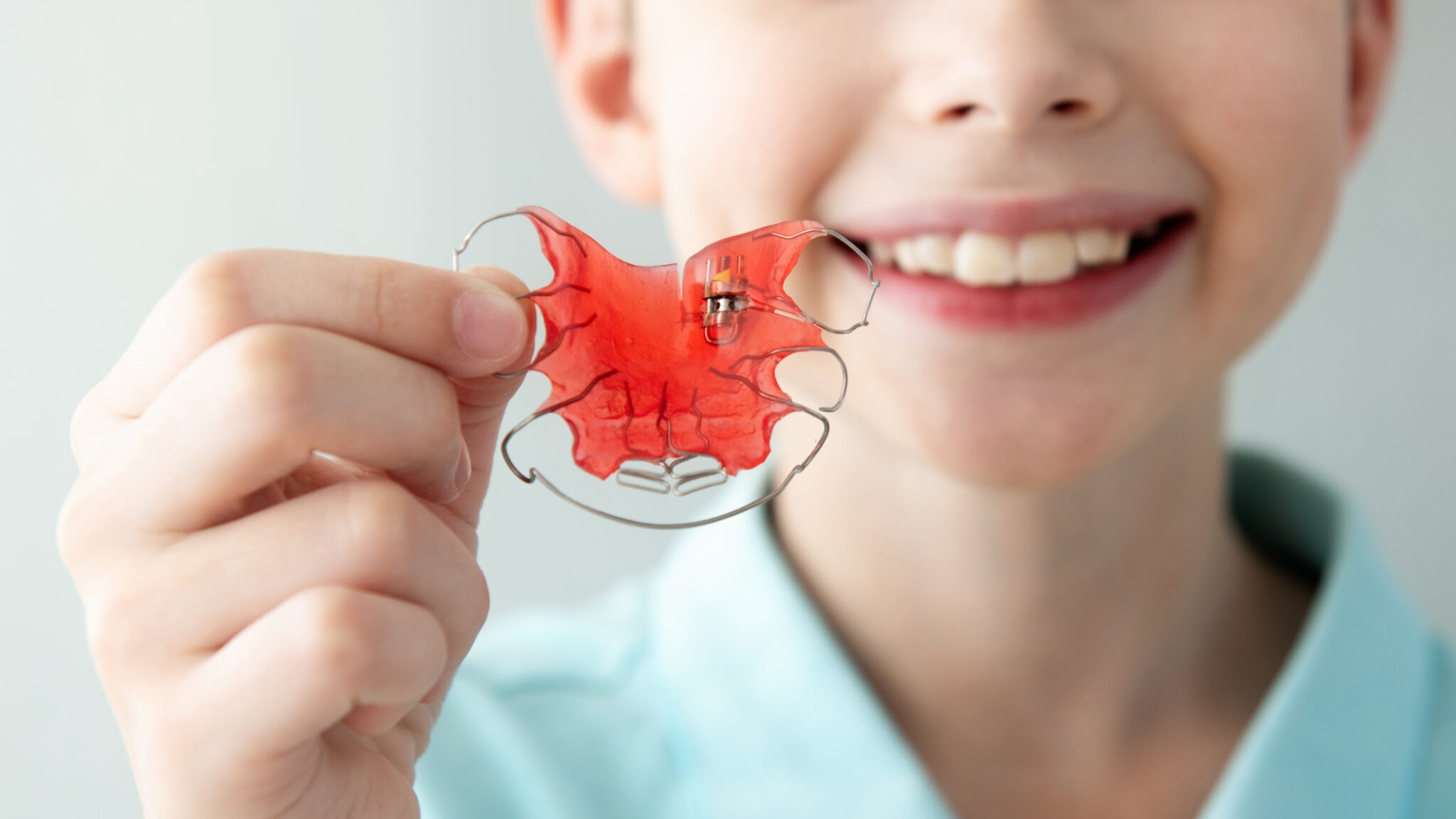 Исправление прикуса ортодонтическими пластинками