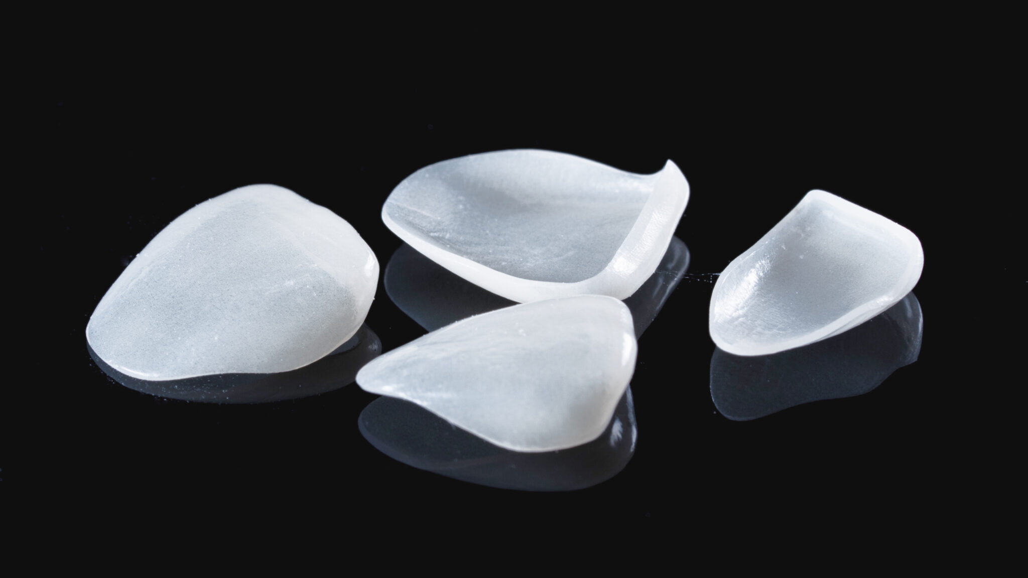 Исправление прикуса винирами и люминирами