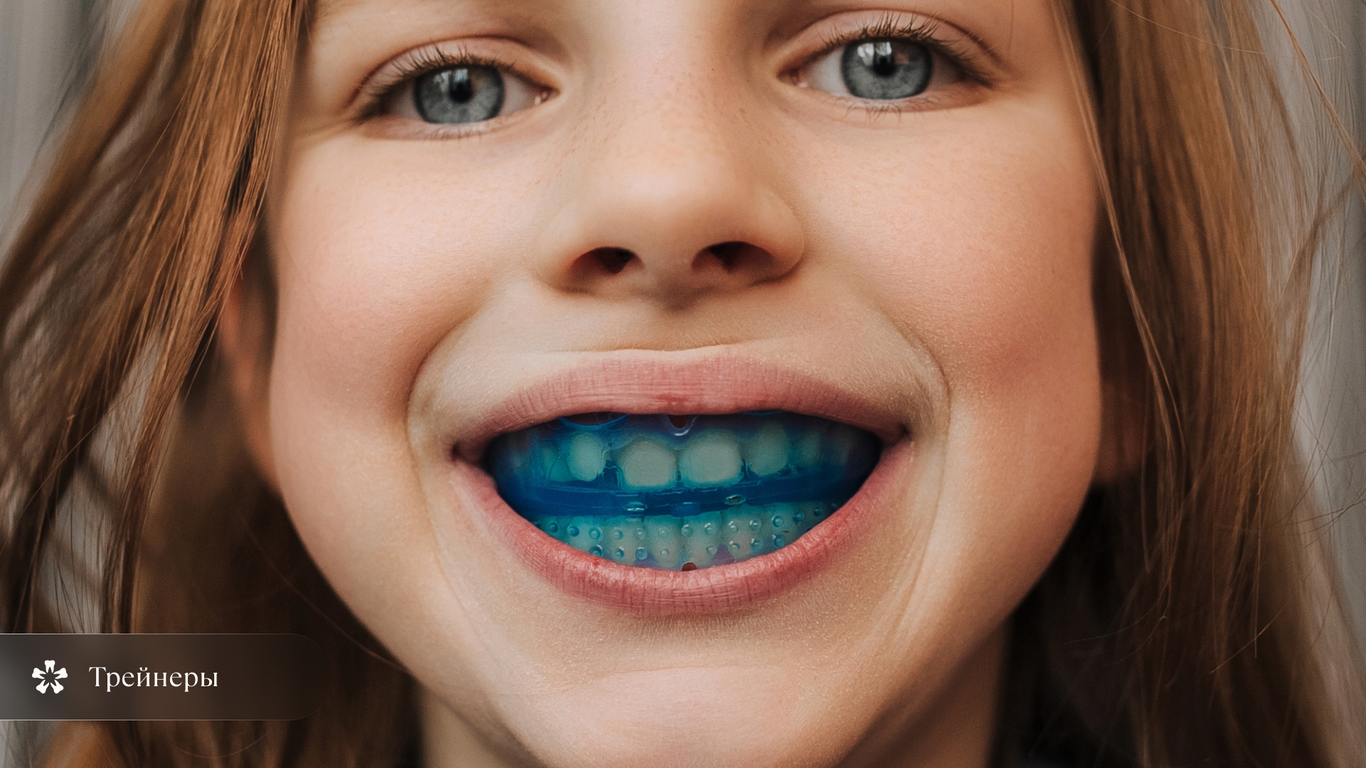 Ортодонтические трейнеры для исправления открытого прикуса у детей