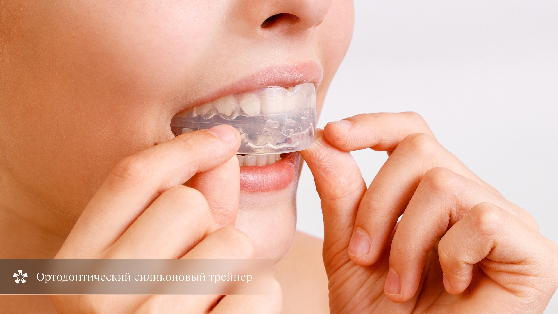 Ортодонтический силиконовый трейнер
