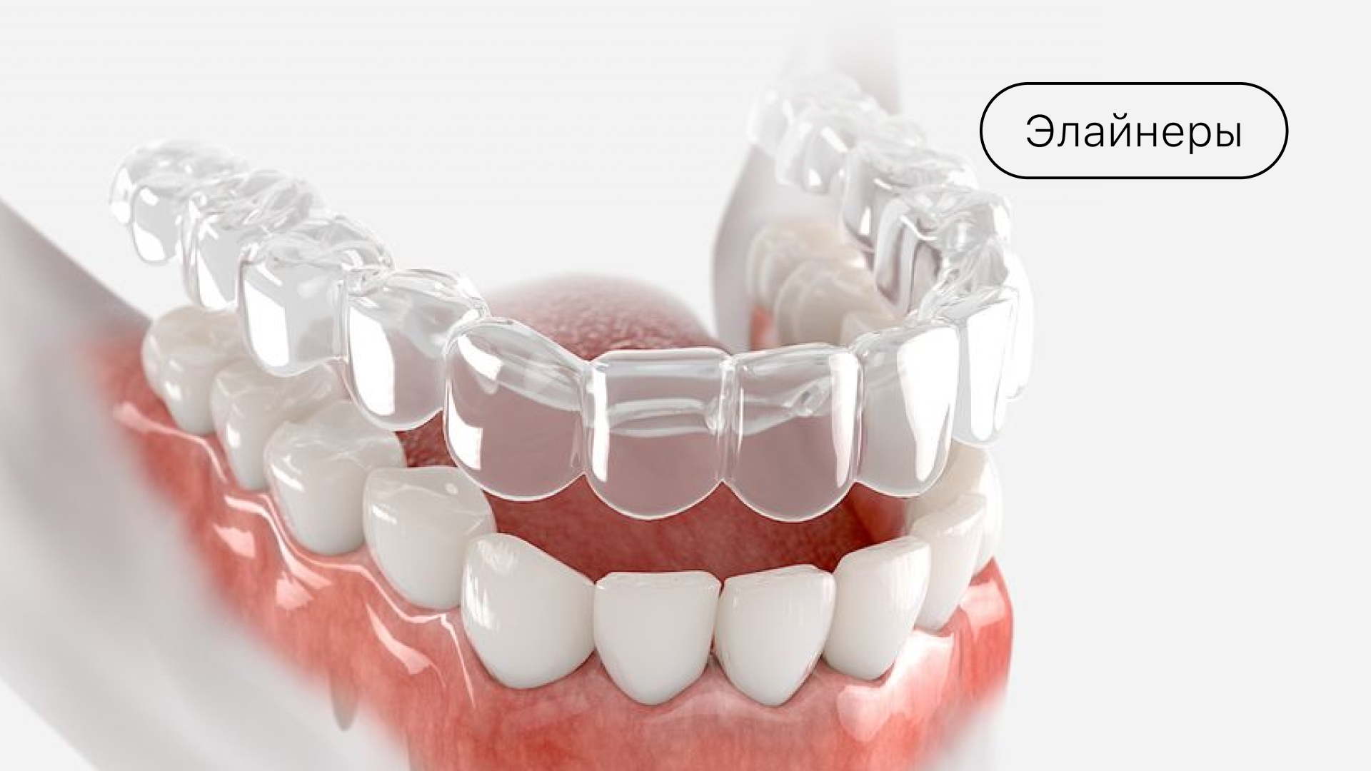 Элайнеры
