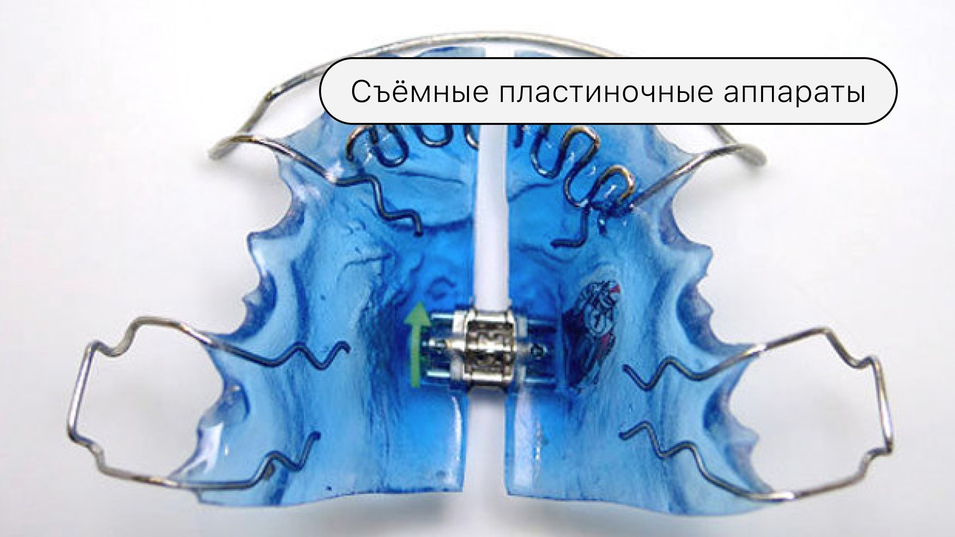 Съёмные пластиночные аппараты