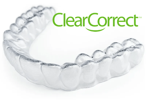 Элайнеры Spark Aligners